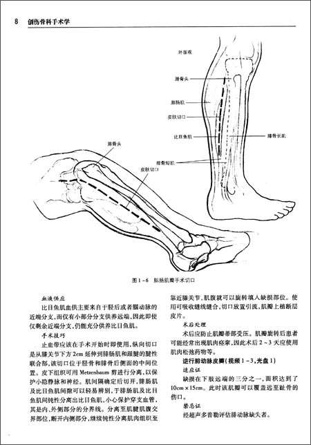 创伤骨科手术学(附光盘)\/斯坦纳德 (James P. S