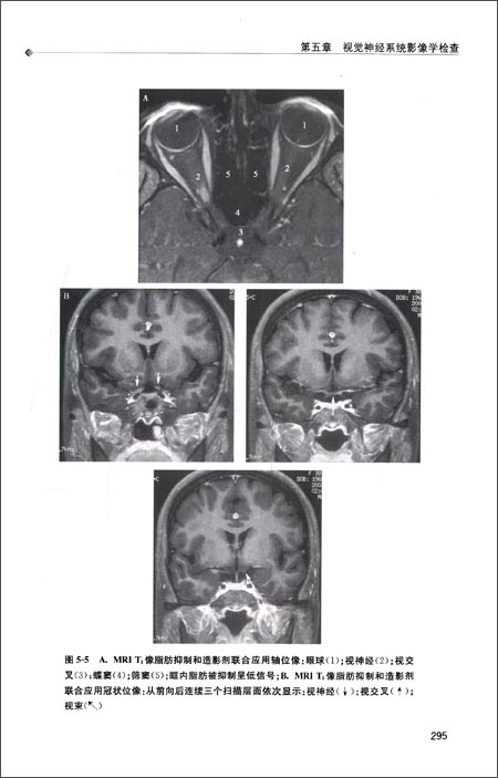 视觉神经系统疾病定位诊断学 \/金崇华-图书杂志