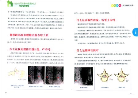 人生必须知道的健康知识科普系列丛书:脊柱外