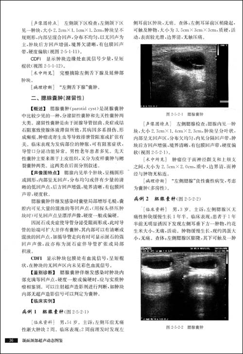 颌面颈部超声动态图鉴(附DVD-ROM光盘1张)\/