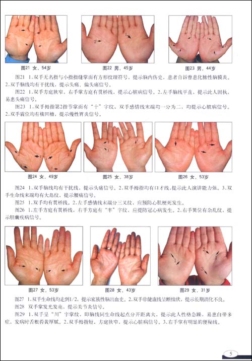 便携式手诊挂图(附光盘1张)\/赵理明