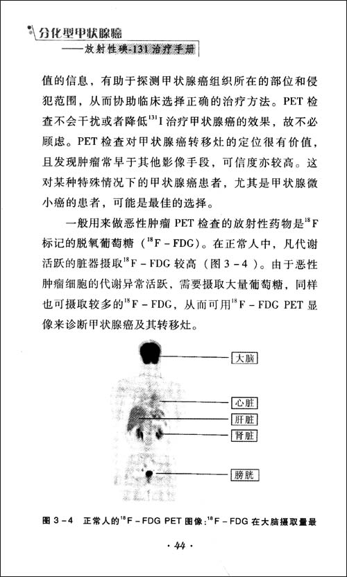 分化型甲状腺癌:放射性碘-131治疗手册\/匡安仁