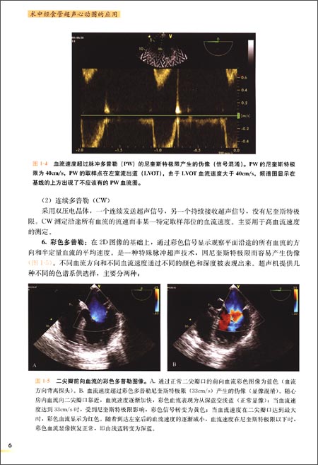 高级麻醉医师系列丛书:术中经食管超声心动图的应用