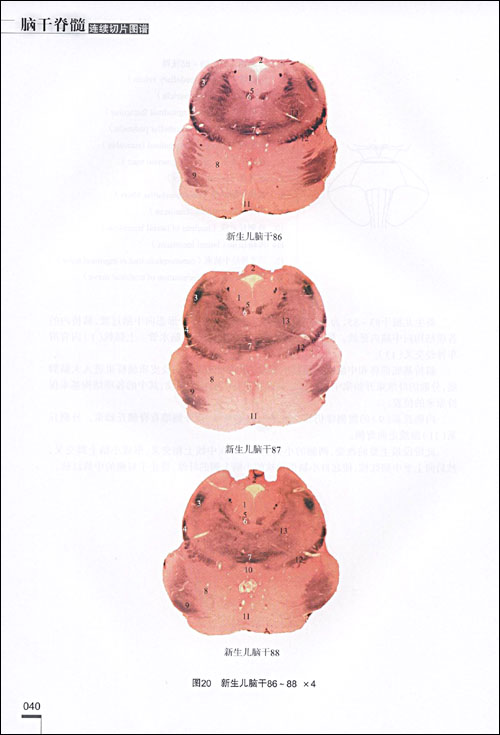 脑干脊髓连续切片图谱(精)\/王云祥