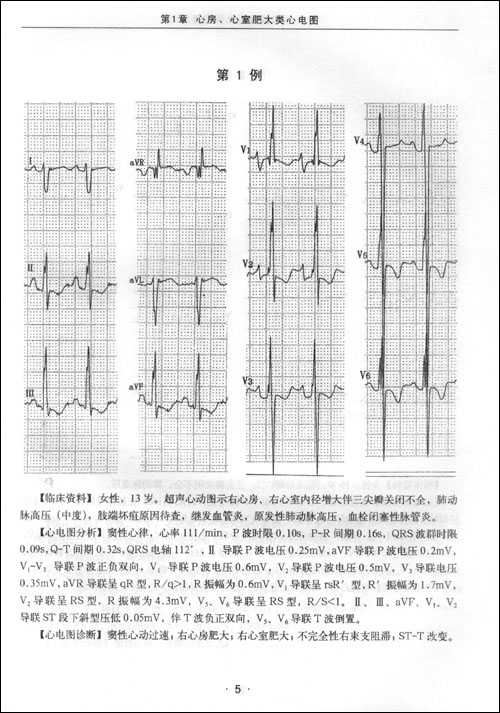 301医院心电图图谱\/卢喜烈,周军荣 主编:图书比