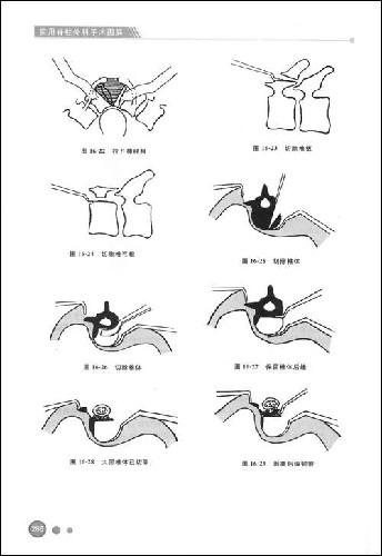 实用脊柱外科手术图解