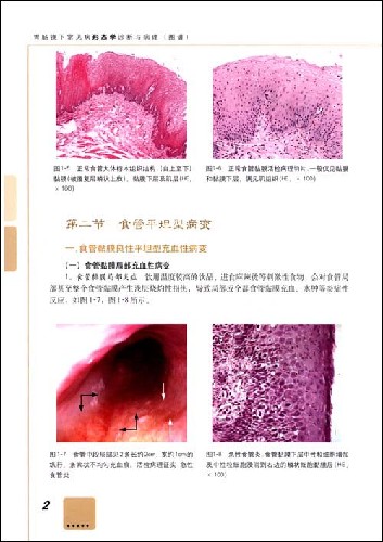 胃肠镜下常见病形态学诊断与病理(图谱)(附CD