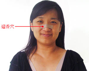 过敏引起的鼻塞适用)8帖*2